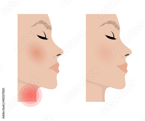 Woman suffering from sore throat and inflammation