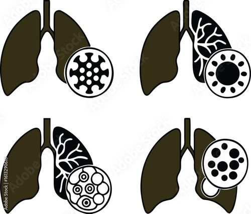 Black Icons of Lung Disease, Bronchitis, COPD, and Pneumonia. Vector Icons of Various Lung Diseases. Healthcare and Medicine
