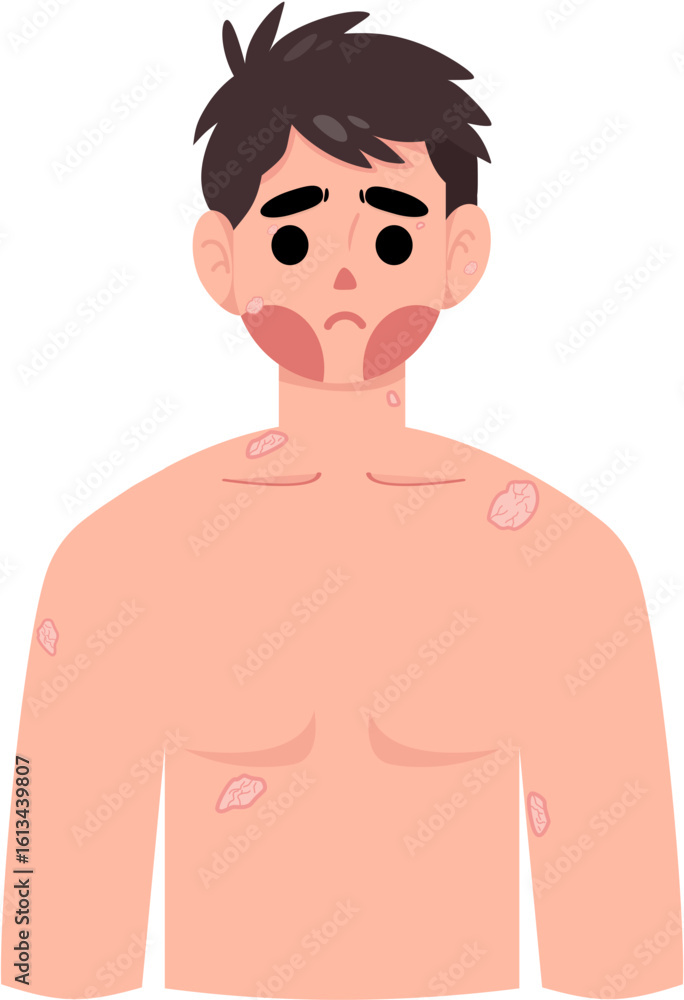 Fototapeta premium Warts