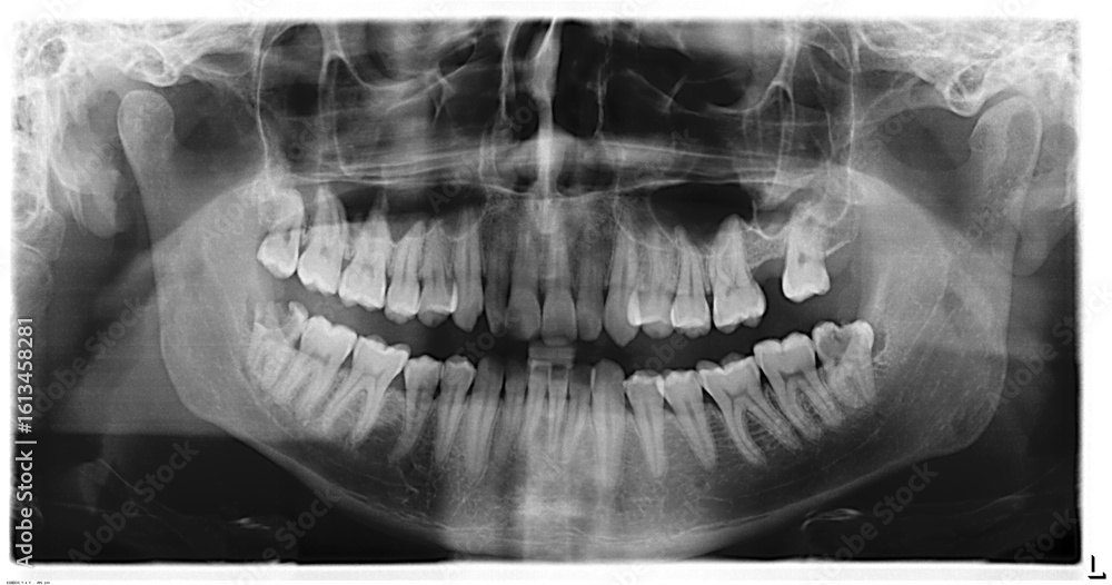 Obraz premium dental x ray