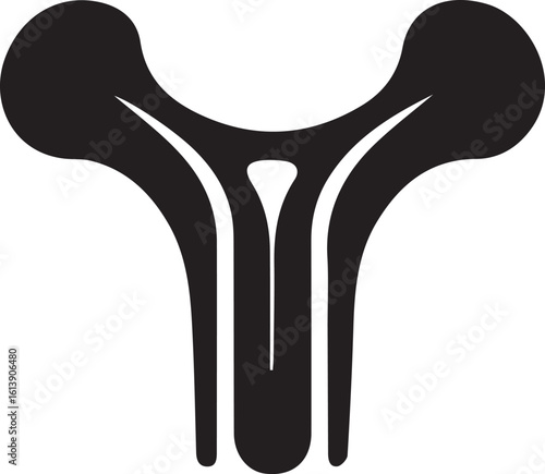 Illustration of an x ray of a bone