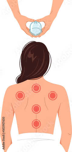 Therapist applying cupping therapy to woman s back for relaxation