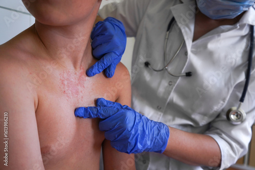 A doctor in blue gloves examines the rash on the boy's body.