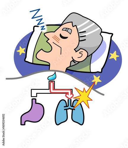 睡眠中に誤嚥