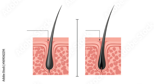 Understanding hair follicle structure and growth cycles explaining healthy hair versus thinning hair patterns
