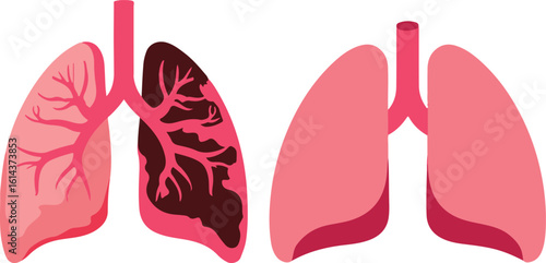 Understanding Lung Health: Healthy vs. Diseased Lungs vector