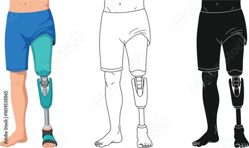 Exploring leg prosthesis options: types, benefits, and modern prosthetic technology solutions guide editable