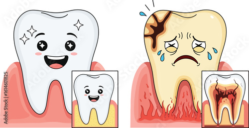 Understanding tooth decay cartoon illustration for dental health and oral hygiene awareness