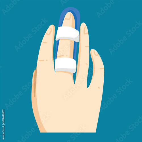 Finger splint on hand, treatment for injury or fracture