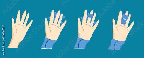 Step-by-Step Finger Bandage Tutorial for Hand Injury Care

