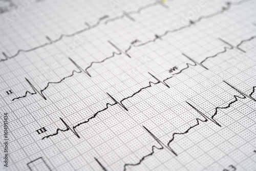 Foto Red heart on electrocardiogram ECG with red heart, heart wave, heart attack, cardiogram report