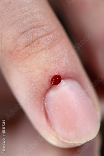 a blood drop on the finger in the line with the nail, the skin, the blood, the red