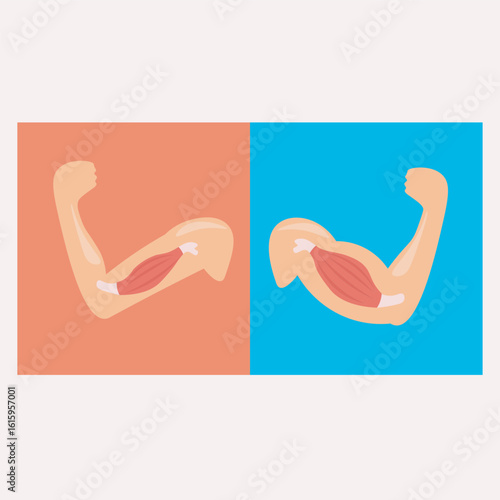 Becker muscular dystrophy vector: strong vs weak muscle hands, showing muscle loss, symptoms, and related neuromuscular diseases. icon