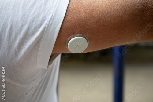 Man Wearing Freestyle Libre Sensor on Arm