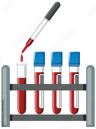 Blood Sample Test Tubes and Dropper in Rack