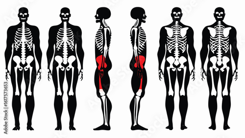 A clear and educational visual breakdown of the human skeleton from multiple perspectives, enhanced by muscle group highlights on the gluteal and posterior thigh regions. This diagram presents six ana