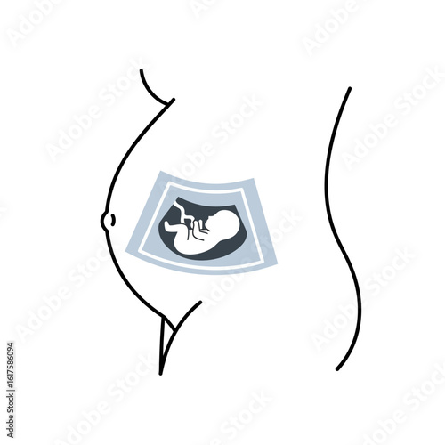 Pregnant woman's profile with visible ultrasound image of fetus.