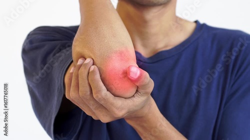 a man massages his sore elbow after being hit by a hard object, facing the camera. health dan medical concept