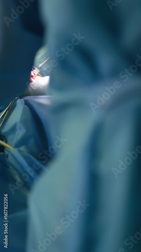 Medical team performing septoplasty rhinoplasty surgery in sterile operating room, modern healthcare concept.