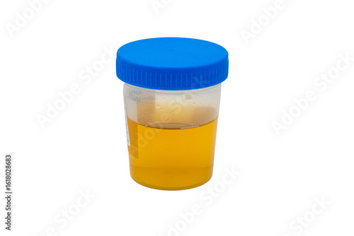 Urine sample