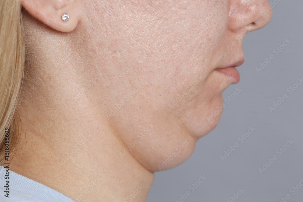 Obraz premium Woman with double chin on grey background, closeup