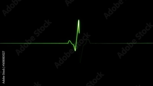 Cardiac arrest on the medical monitor, heart stops beating. Heart beating then hearts deadline on black background. Seamlessly loop footage.