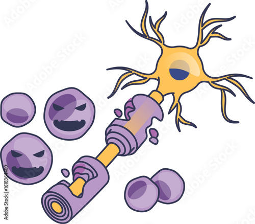 Illustration of T-cells attacking a neuron's myelin sheath. This cartoon depicts the autoimmune process of demyelination, a key factor in diseases like multiple sclerosis.