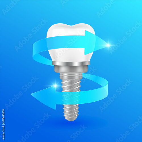 Two arrows blue rotating around dental implant on dark background. For design dentist or dentistry treatments. Vector EPS10.