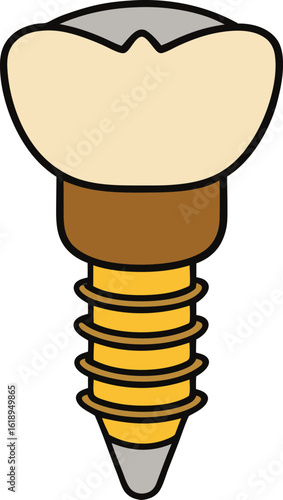 Realistic metallic gold dental implant screw and crown illustration on white background