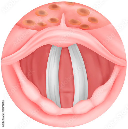 Obraz na płótnie Epiglottis and Vocal Cords View
