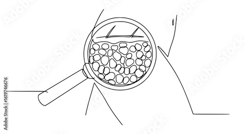 Hand holding magnifying glass, fat deposits on thighs, cellulite - single line vector outline concept