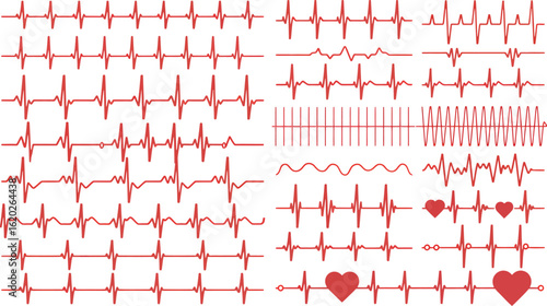 Various red ekg heart beat patterns on a white background showing different heart conditions and rhythms silhouette