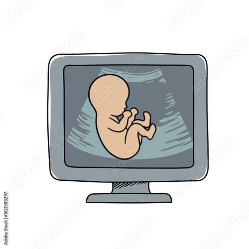 Ultrasound image of fetus displayed on computer screen in hand-drawn style  
