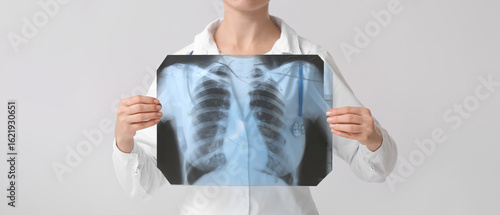 Foto Female doctor with x-ray image of lungs on grey background