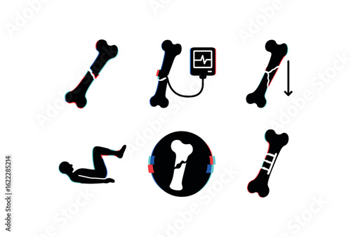 six different glitch effect illustration isolated on white backgorund femoral fracture periosteal callus formation femoral fracture compartment pressure monitor femoral fracture