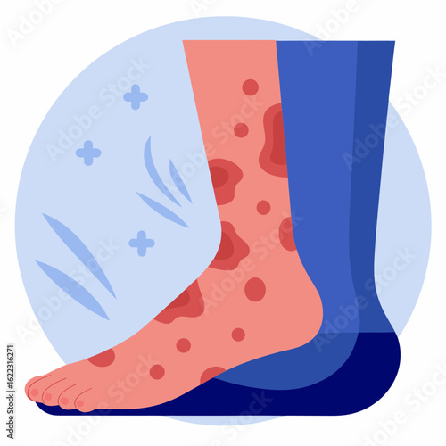 Illustration of foot with contact dermatitis and clear skin on blue circle  