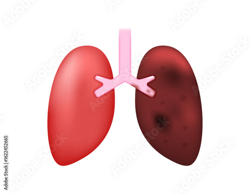 Illustration of damaged and darkened lungs. Cancer or infection. Problematic and unhealthy lungs. Inflammation and disease. Health problems. Minimalist 3D style design. Elements, symbols, or icons.