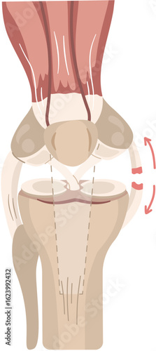 complete tear medial collateral ligament injury