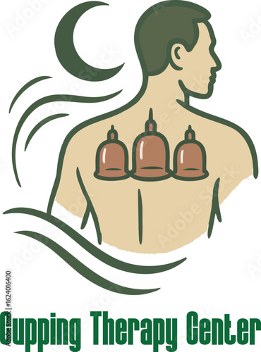 Cupping Therapy Center