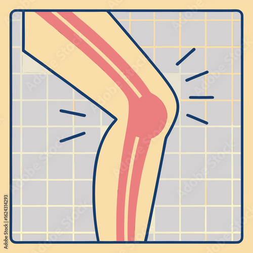 Illustration of a painful knee joint with bone and inflammation symptoms