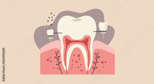 Diagram of tooth and gum with dental crown. Background shows oral health elements