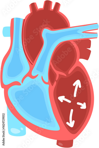 Heart failure 