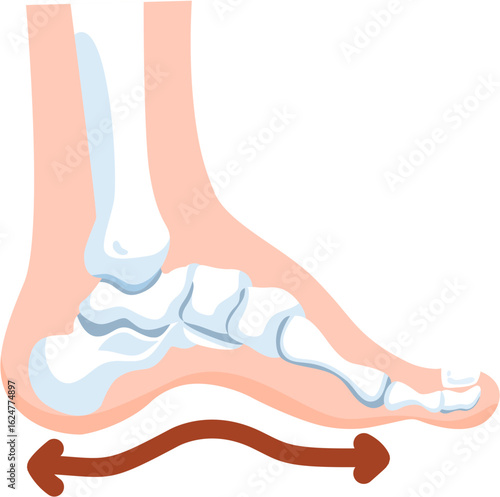 Cavus feet
