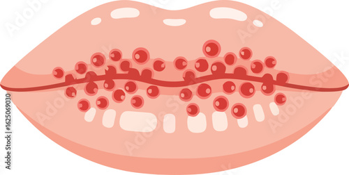 Illustration of a human mouth with small red spots on the inner lips, likely depicting a skin condition.