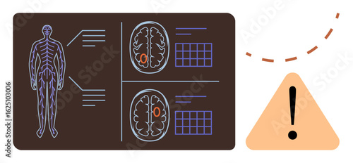 Human body outline alongside brain scan images, connected data points, and alert icon. Ideal for healthcare, neurology, diagnostics, anatomy, alert system medicine research. Simple flat metaphor