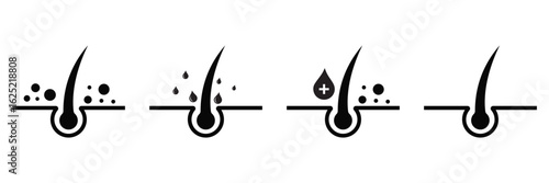 Anti Dandruff Treatment Icon Set – Hair Care Line Symbols for Shampoo and Cosmetic Packaging Design