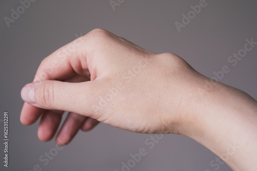 Female right back hand with ganglion cyst on the dorsum,  fluid-filled bump associated with a joint or tendon sheath, close-up view, selected focus.