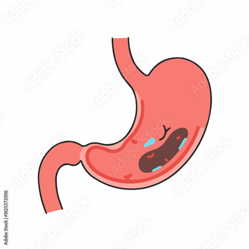 Stomach illustration showing ulcer with internal details in flat style  