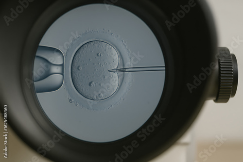 Microscopic view of in vitro fertilization process, needle injecting sperm into human egg cell, assisted reproductive technology, medical laboratory close up, IVF procedure for fertility and embryolog