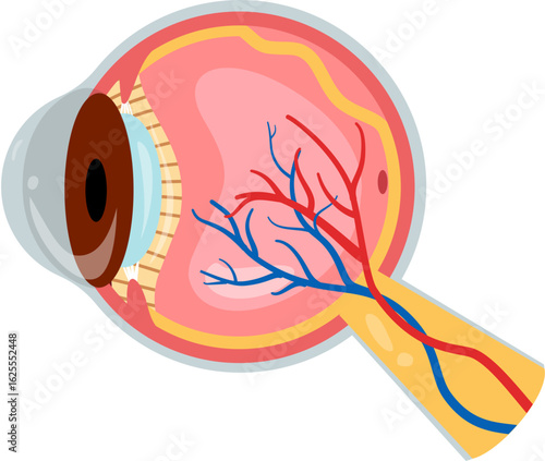 Retinal detachment 
